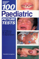 1- Pediatrics OSCE.pdf